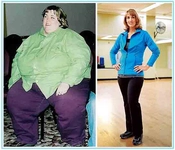 Kortizon Sonrası Zayıflama Nasıl Olur?